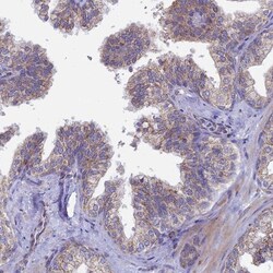Testican 2/SPOCK2 Antibody, Novus Biologicals:Antibodies:Primary Antibodies